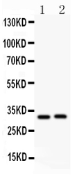 Anti-IL1 beta antibody used in Western Blot (WB). GTX11904