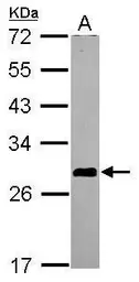 Anti-ASB7 antibody used in Western Blot (WB). GTX119040
