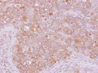 Anti-p190-B RhoGAP antibody used in IHC (Paraffin sections) (IHC-P). GTX119041