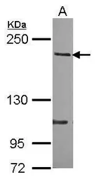 Anti-p190-B RhoGAP antibody used in Western Blot (WB). GTX119041