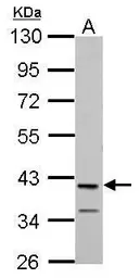 Anti-MAB21L1 antibody used in Western Blot (WB). GTX119053
