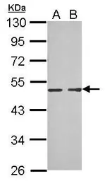 Anti-MAB21L1 antibody used in Western Blot (WB). GTX119053