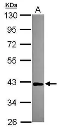 Anti-MAB21L1 antibody used in Western Blot (WB). GTX119053