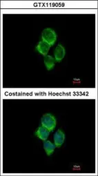 Anti-SLC22A18AS antibody used in Immunocytochemistry/ Immunofluorescence (ICC/IF). GTX119059