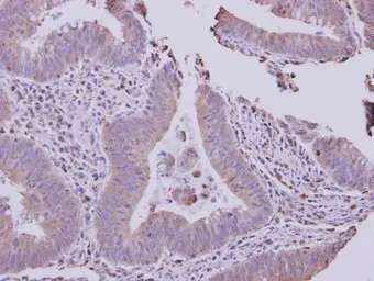 Anti-SLC22A18AS antibody used in IHC (Paraffin sections) (IHC-P). GTX119059