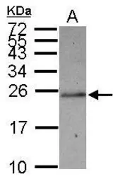 Anti-SLC22A18AS antibody used in Western Blot (WB). GTX119059