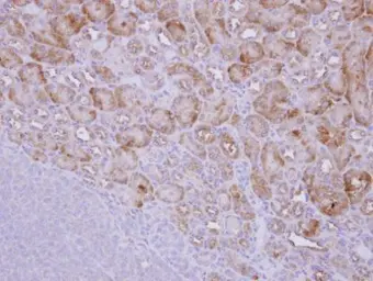 Anti-CALM antibody used in IHC (Paraffin sections) (IHC-P). GTX119084