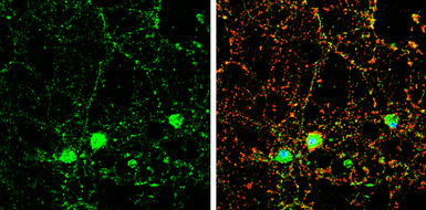 Anti-DOC2A antibody [N2C3] used in Immunocytochemistry/ Immunofluorescence (ICC/IF). GTX119085