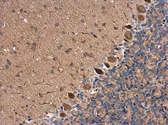 Anti-RAB11B antibody [N1C3] used in IHC (Paraffin sections) (IHC-P). GTX119095