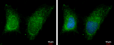 Anti-RAB11B antibody [N1C3] used in Immunocytochemistry/ Immunofluorescence (ICC/IF). GTX119095