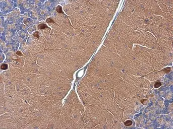 Anti-RAB11B antibody [N1C3] used in IHC (Paraffin sections) (IHC-P). GTX119095