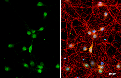 Anti-RAB11B antibody [N1C3] used in Immunocytochemistry/ Immunofluorescence (ICC/IF). GTX119095