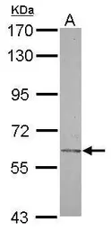 Anti-CHST2 antibody [N3C3] used in Western Blot (WB). GTX119099