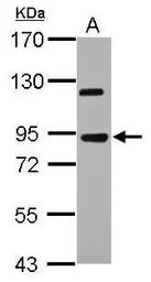 Anti-KIAA0317 antibody [N1N2], N-term used in Western Blot (WB). GTX119103