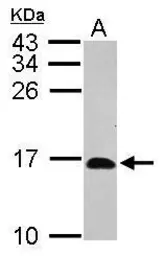 Anti-HRSP12 antibody used in Western Blot (WB). GTX119107