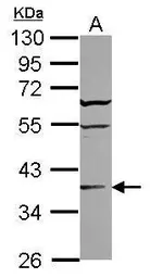 Anti-ST6GALNAC2 antibody [N3C3] used in Western Blot (WB). GTX119112