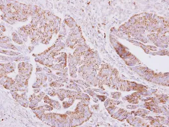 Anti-ST6GALNAC2 antibody [N3C3] used in IHC (Paraffin sections) (IHC-P). GTX119112