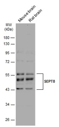 Anti-SEPT8 antibody used in Western Blot (WB). GTX119118