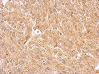 Anti-SEPT8 antibody used in IHC (Paraffin sections) (IHC-P). GTX119118