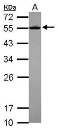 Anti-SEPT8 antibody used in Western Blot (WB). GTX119118