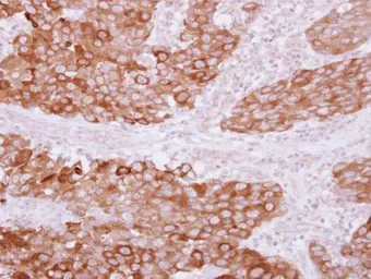 Anti-PITPNB antibody used in IHC (Paraffin sections) (IHC-P). GTX119123