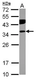 Anti-PITPNB antibody used in Western Blot (WB). GTX119123
