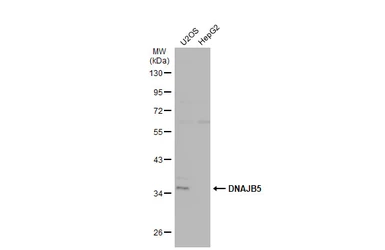 Anti-DNAJB5 antibody used in Western Blot (WB). GTX119124