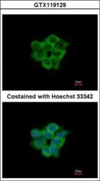 Anti-ACOT11 antibody [N1N3] used in Immunocytochemistry/ Immunofluorescence (ICC/IF). GTX119129
