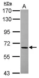 Anti-ACOT11 antibody [N1N3] used in Western Blot (WB). GTX119129