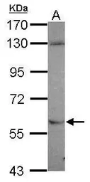 Anti-NDOR1 antibody [N2C2], Internal used in Western Blot (WB). GTX119139