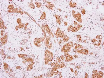 Anti-MOCS3 antibody [N3C3] used in IHC (Paraffin sections) (IHC-P). GTX119140
