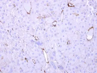 Anti-HECA antibody [C1C3] used in IHC (Paraffin sections) (IHC-P). GTX119157