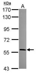 Anti-HECA antibody [C1C3] used in Western Blot (WB). GTX119157