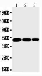 Anti-IKK gamma antibody used in Western Blot (WB). GTX11916