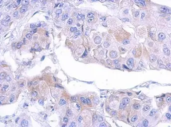 Anti-MTMR12 antibody used in IHC (Paraffin sections) (IHC-P). GTX119163