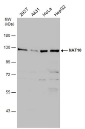 Anti-NAT10 antibody used in Western Blot (WB). GTX119167