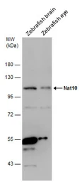 Anti-NAT10 antibody used in Western Blot (WB). GTX119167