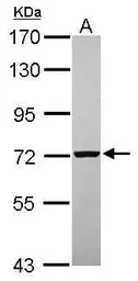 Anti-PGM2 antibody [N1C2] used in Western Blot (WB). GTX119168