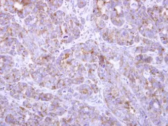 Anti-FBL8 antibody used in IHC (Paraffin sections) (IHC-P). GTX119171