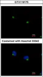 Anti-IFT122 antibody [C1C2], Internal used in Immunocytochemistry/ Immunofluorescence (ICC/IF). GTX119175