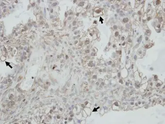 Anti-PCDHGC4 antibody [N1N2], N-term used in IHC (Paraffin sections) (IHC-P). GTX119180