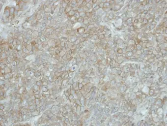 Anti-PCDHGB5 antibody [N1N2], N-term used in IHC (Paraffin sections) (IHC-P). GTX119181
