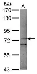 Anti-PCDHB11 antibody [N1N2], N-term used in Western Blot (WB). GTX119185
