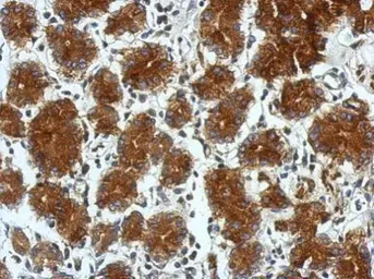 Anti-TSCOT antibody used in IHC (Paraffin sections) (IHC-P). GTX119204