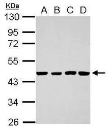 Anti-TSCOT antibody used in Western Blot (WB). GTX119204