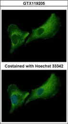 Anti-DNASE2B antibody [N1C3] used in Immunocytochemistry/ Immunofluorescence (ICC/IF). GTX119205