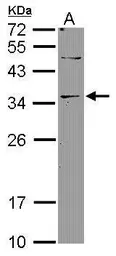 Anti-DNASE2B antibody [N1C3] used in Western Blot (WB). GTX119205