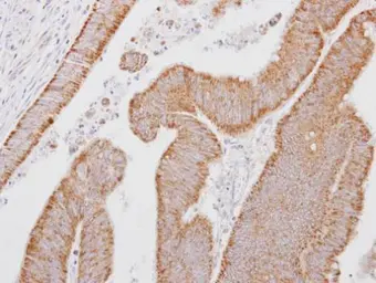 Anti-SMOC1 antibody [N2C3] used in IHC (Paraffin sections) (IHC-P). GTX119208
