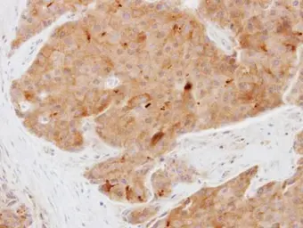 Anti-ATPAF1 antibody [N2C3] used in IHC (Paraffin sections) (IHC-P). GTX119210