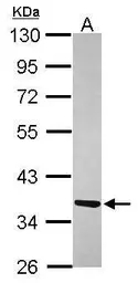 Anti-ATPAF1 antibody [N2C3] used in Western Blot (WB). GTX119210